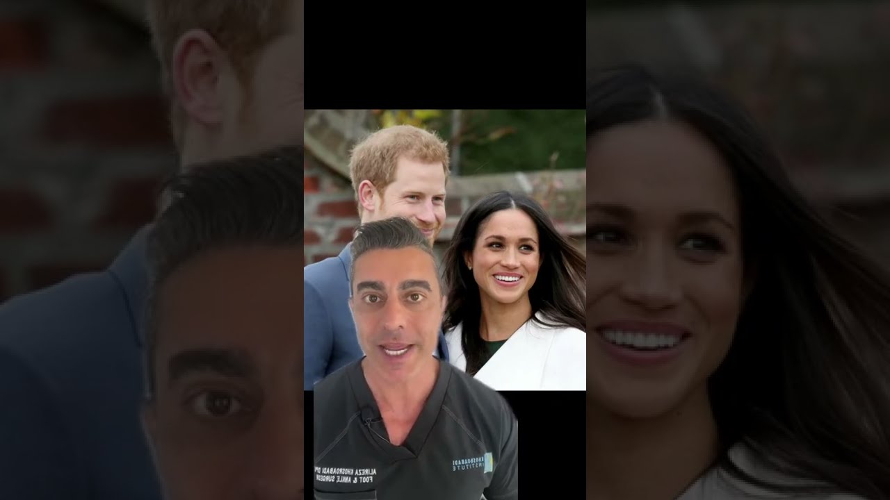Celebrities with foot condition Ep. #1 - Meghan Markle