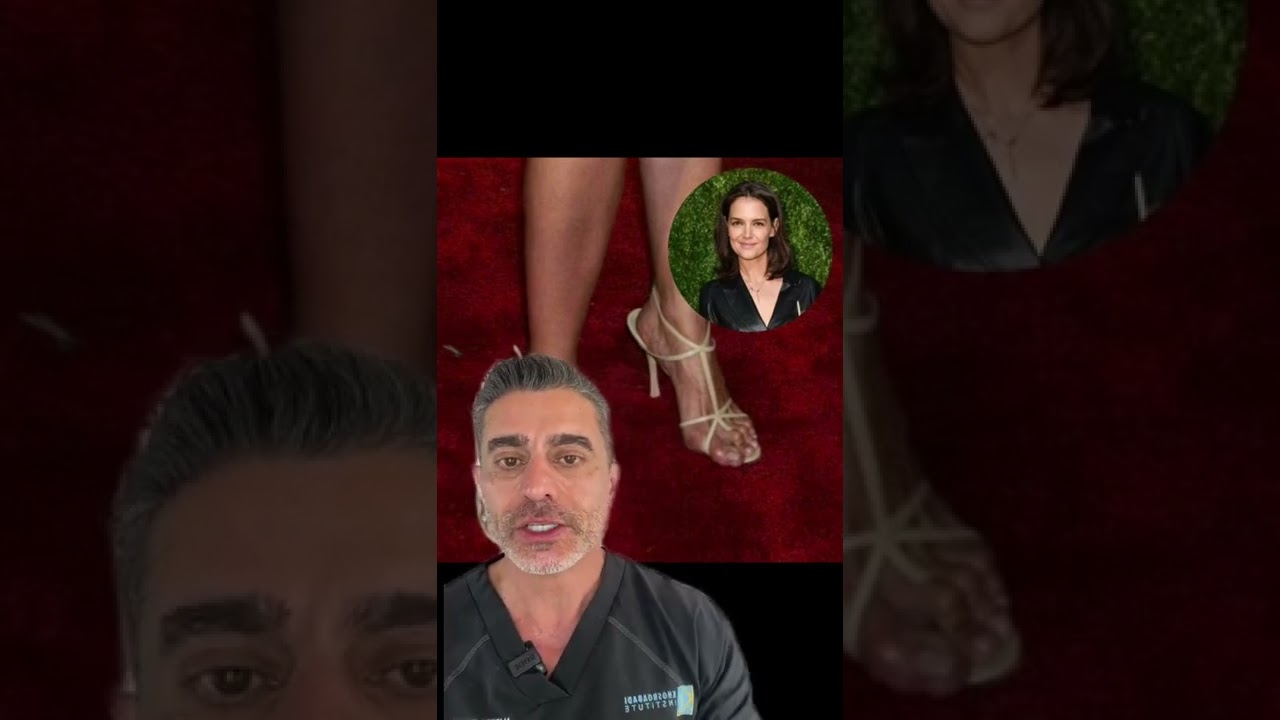 Celebrities with foot condition Ep. #6 Katie Holmes