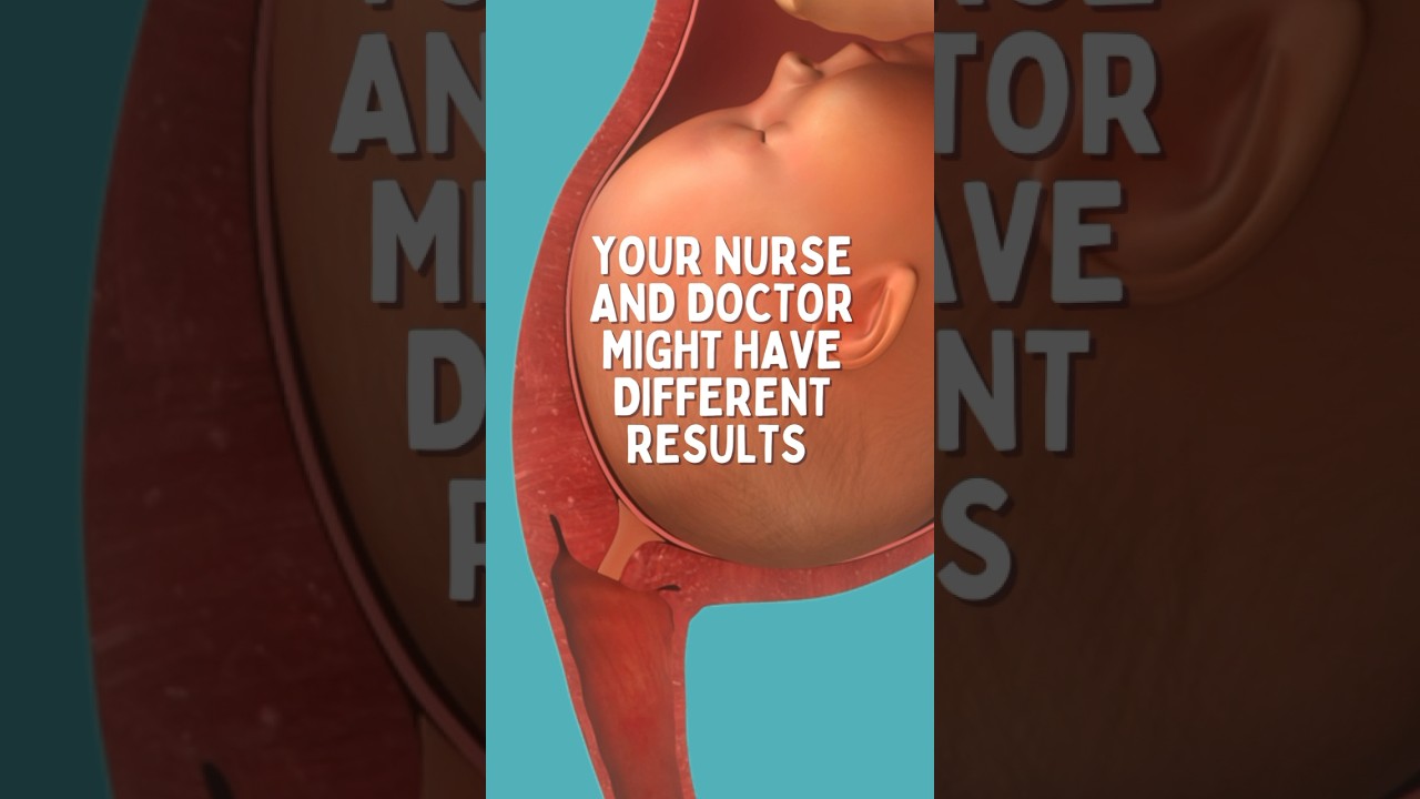 Cervix Exam in Labor and Delivery # birth