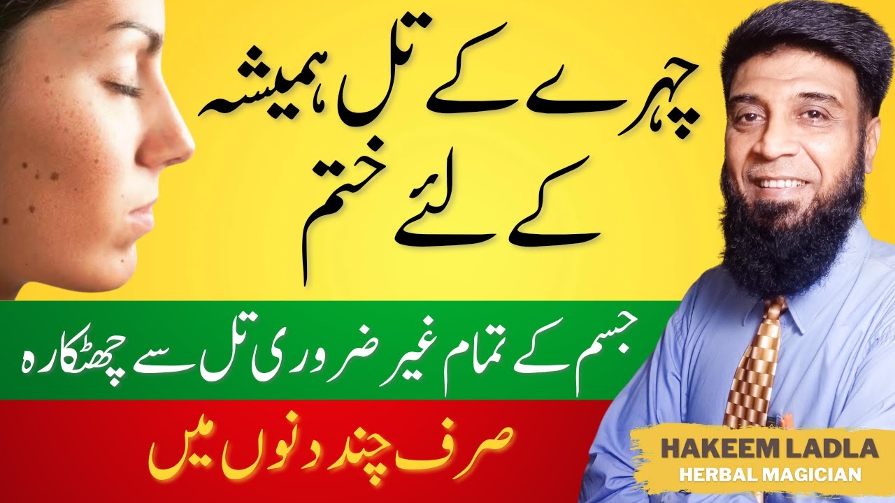Chehry k Til Khatam karne ka Tarika | How to Remove Black and Brown Moles Naturally | Til khatam