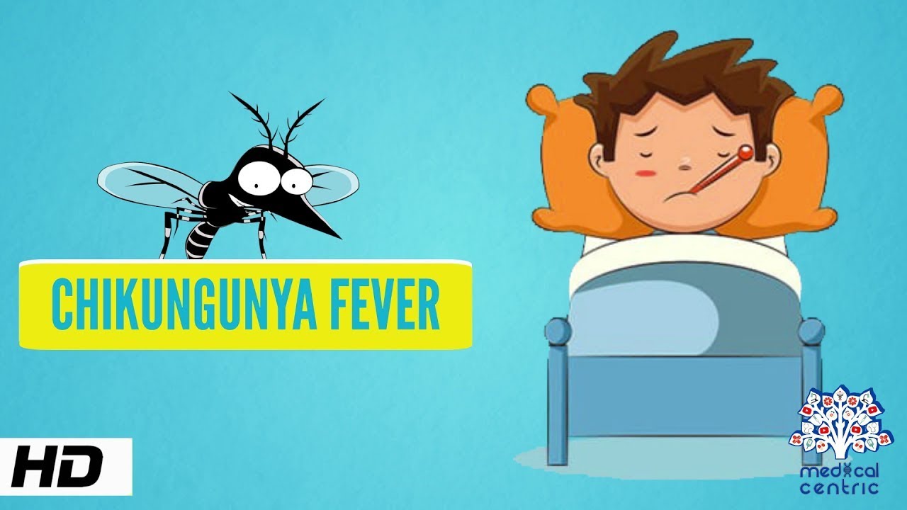 Chikungunya Fever, Causes, Signs and Symptoms,Diagnosis and Treatment.