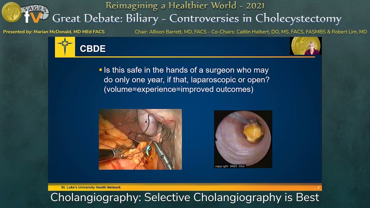 Cholangiography: Selective Cholangiography is Best