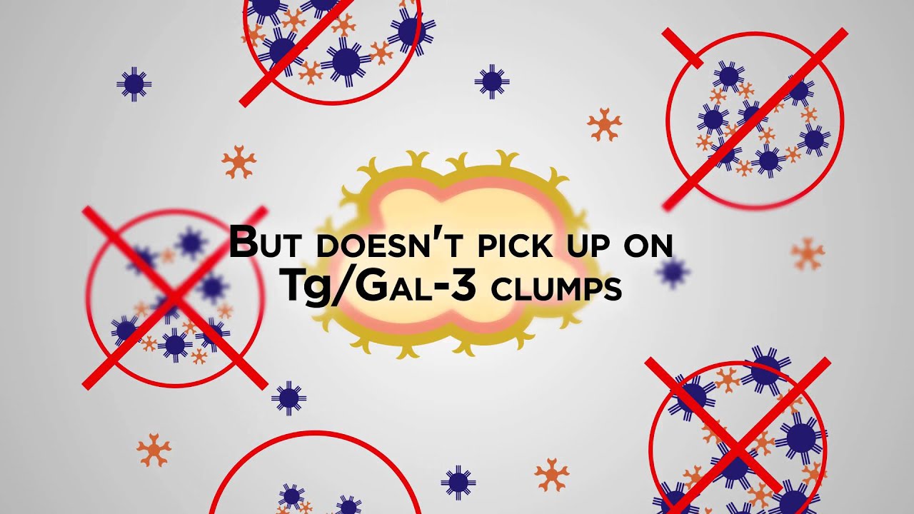 Clumps, Cancer and Thyroid Biomarkers