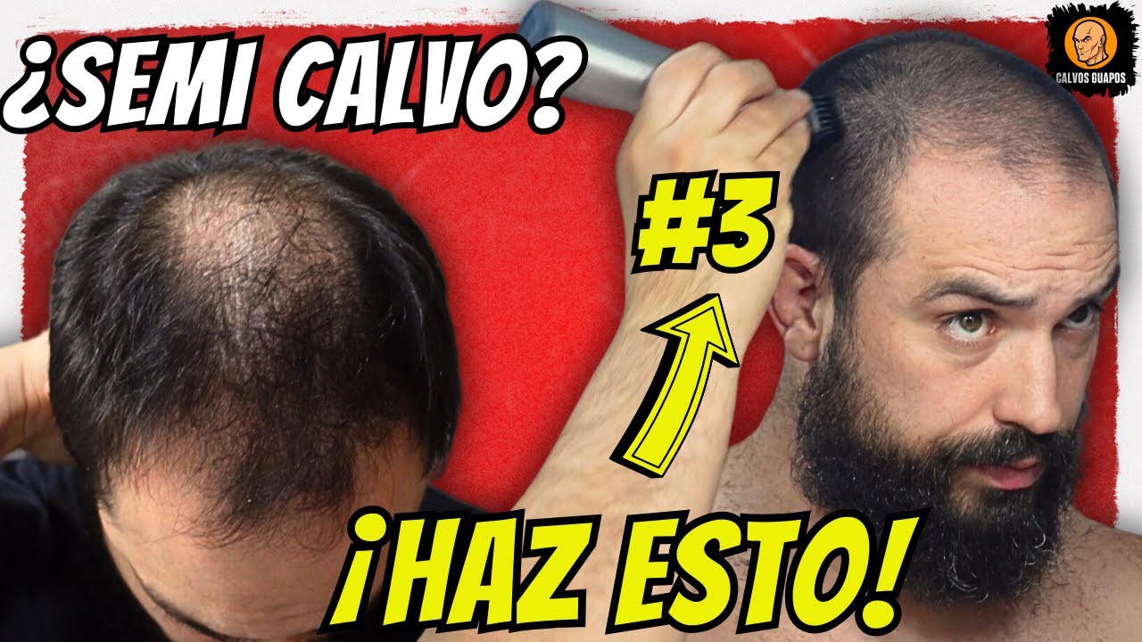 Cómo RAPARSE la CABEZA cuando eres SEMI CALVO - RAPADO al 3