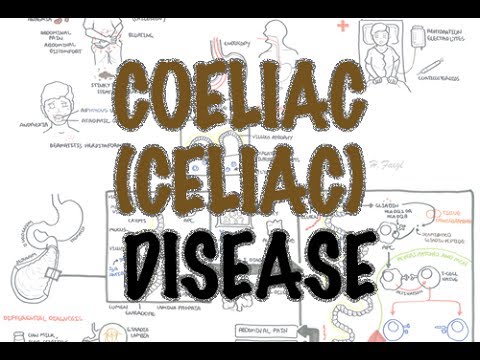 Coeliac (Celiac) Disease - Overview (signs and symptoms, pathophysiology, diagnosis, treatment)