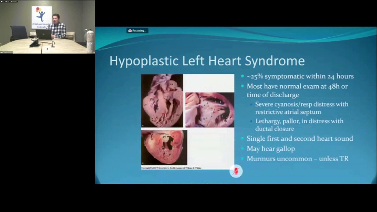 Colorado Virtual Education Series- Critical Congenital Heart Disease (CCHD)