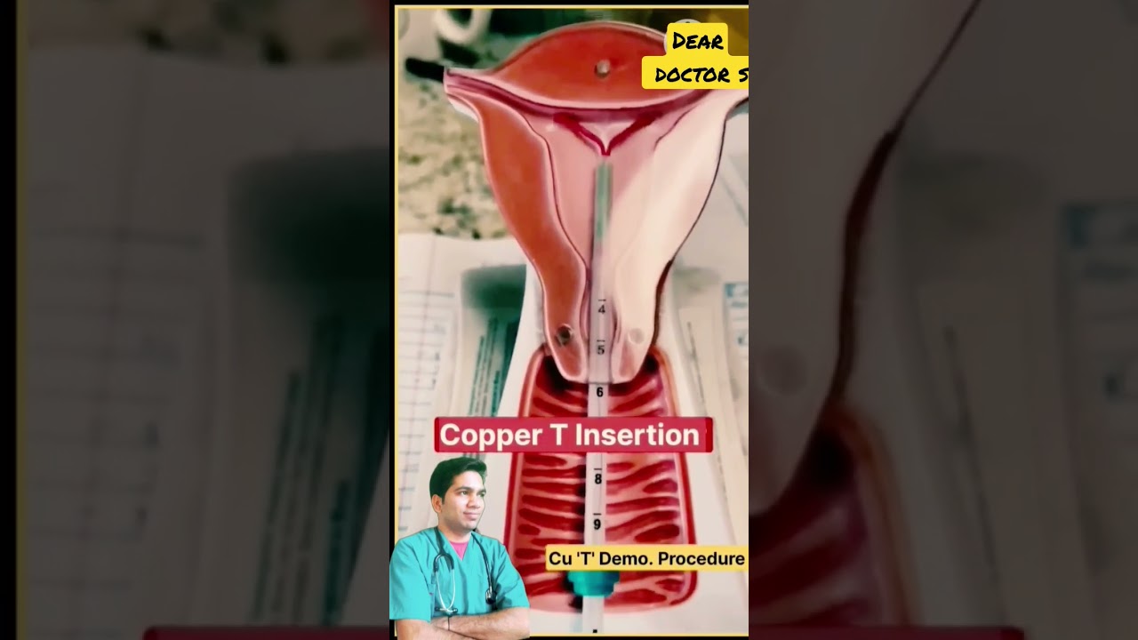 copper T insertion #copper T lagane ki sahi tarika,,