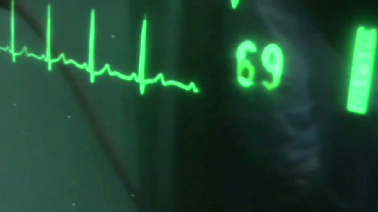 Cpr on women