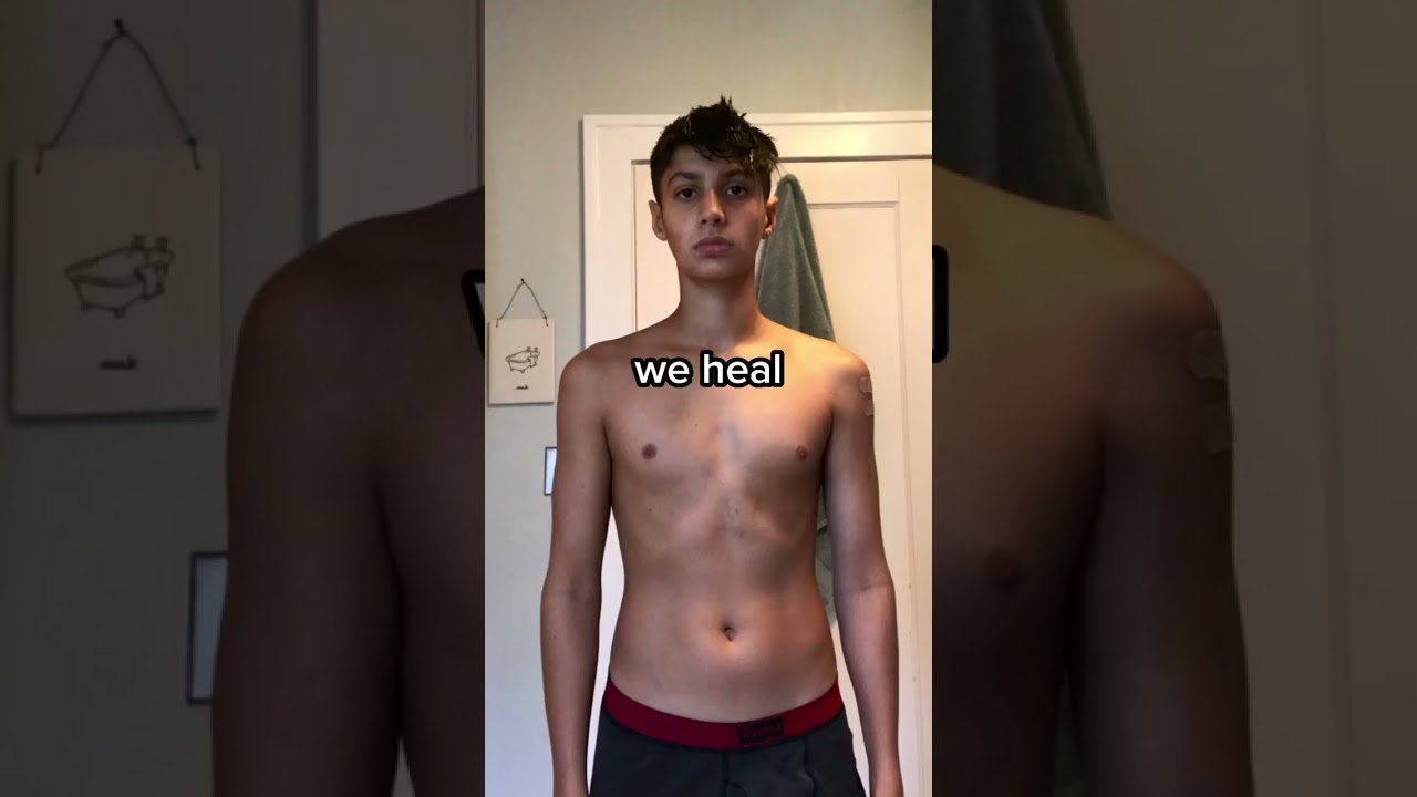 Crazy Teen Body Transformation #fitness #bodybuilding