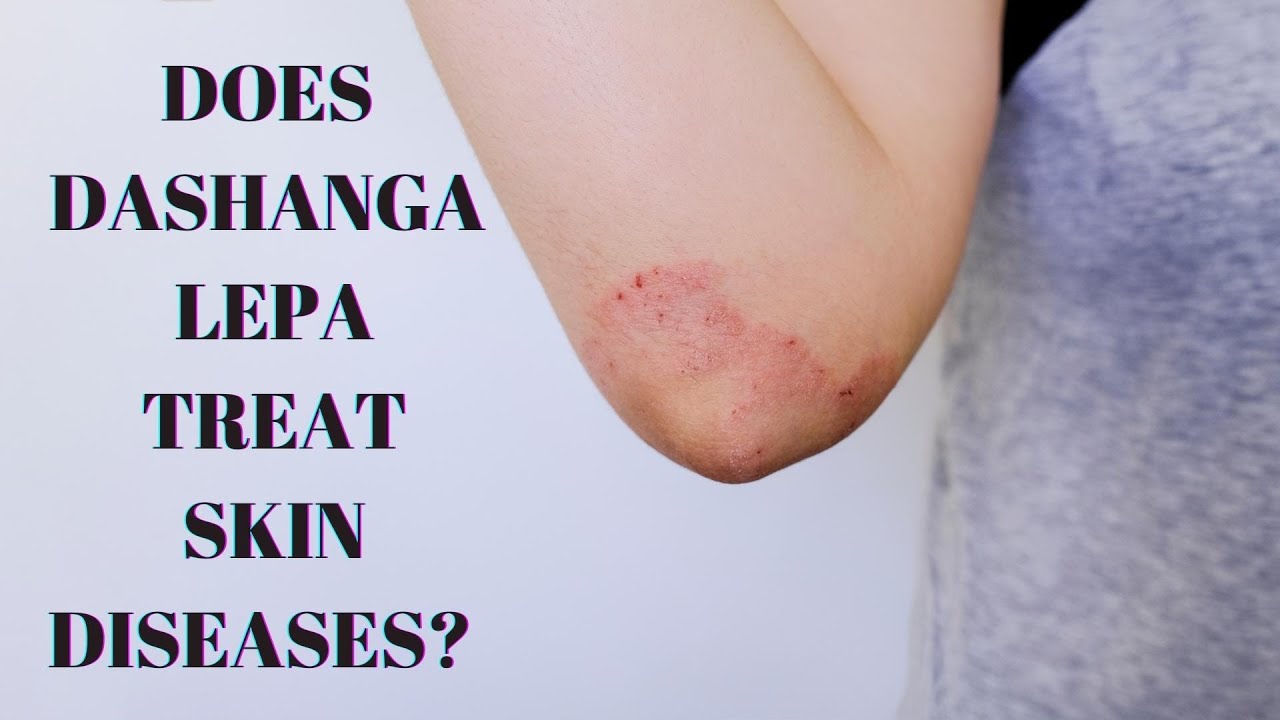 Dashanga Lepa - Benefits, How to use, Ingredients, Side effects