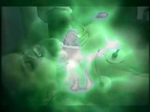 Defibrillation
