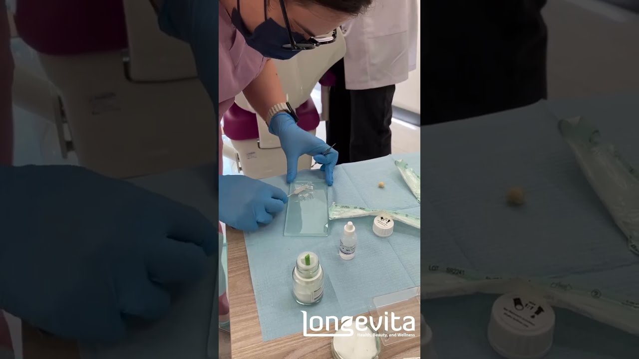 Dental Crown Cementation | Long-Term Solution | Longevita