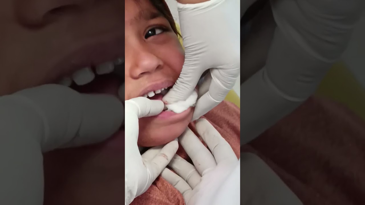 #dentistry #crying #babygirl #baby #doctor