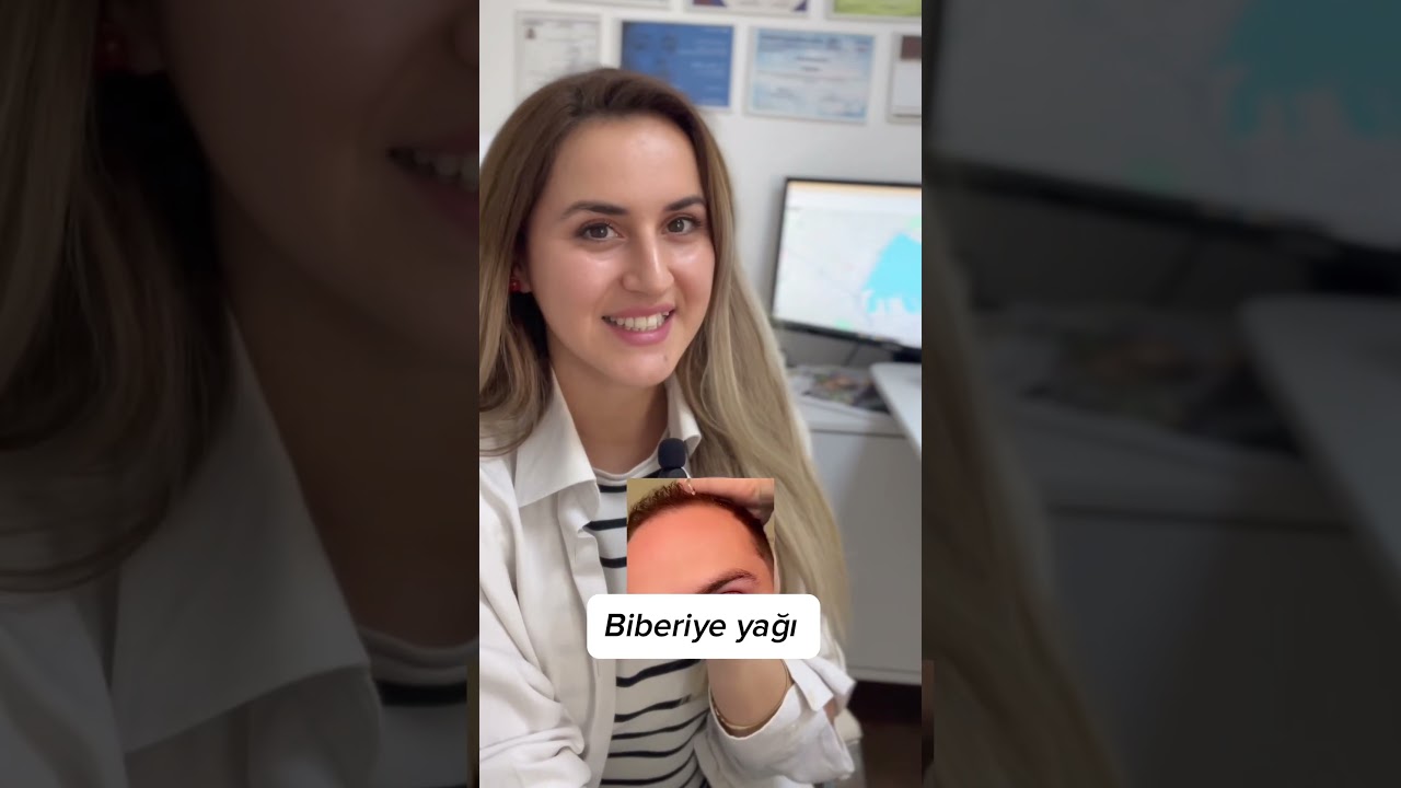 Dermatolog olarak saç bakım trendlerini puanlıyorum ! Biberiye? Minoksidil? Biotin?
