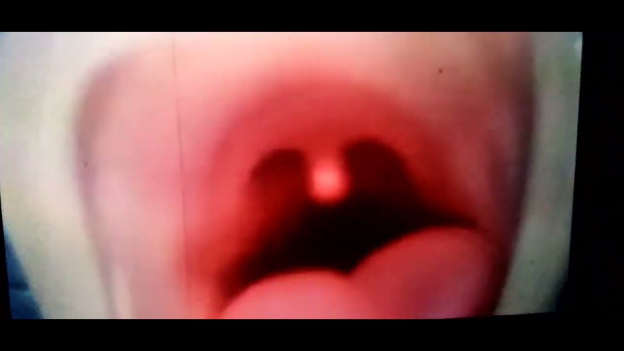 destiny mouth uvula jiggle