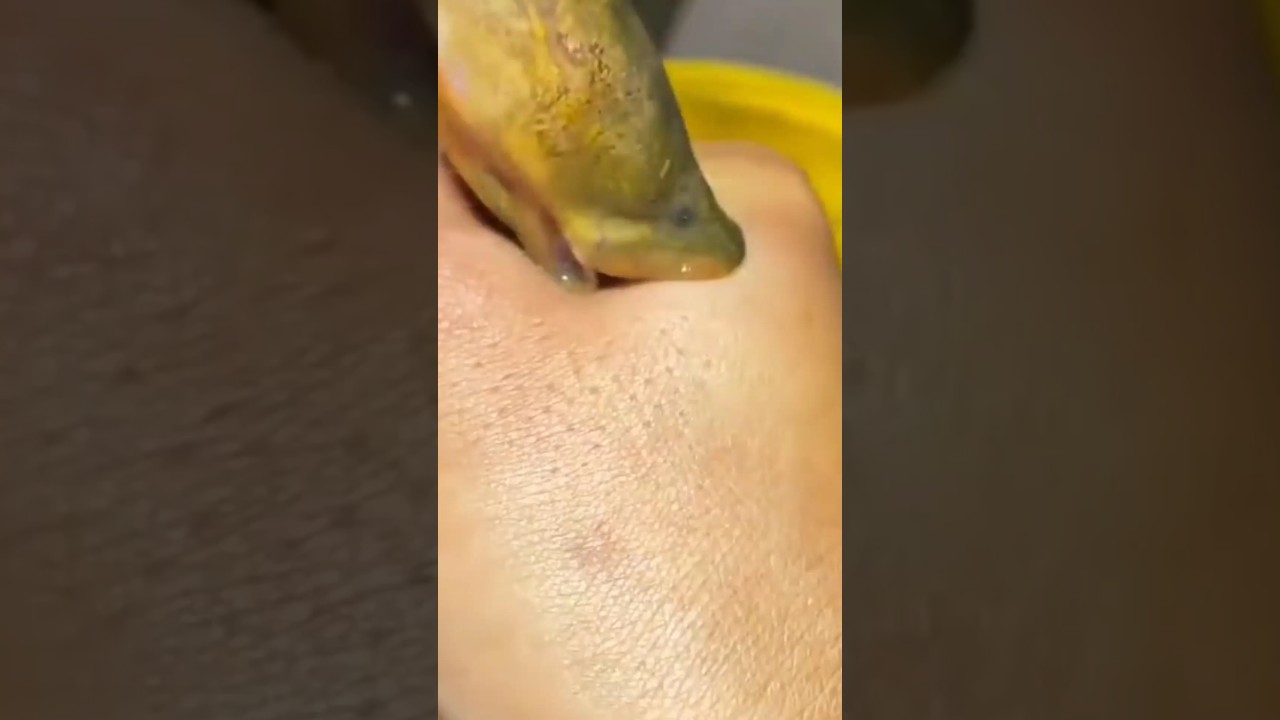 Detik-detik tangan digigit belut!! 😅😅 #shorts
