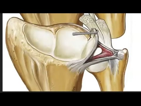 Distal RadioUlnar Joint and Triangular FibroCartilage Complex