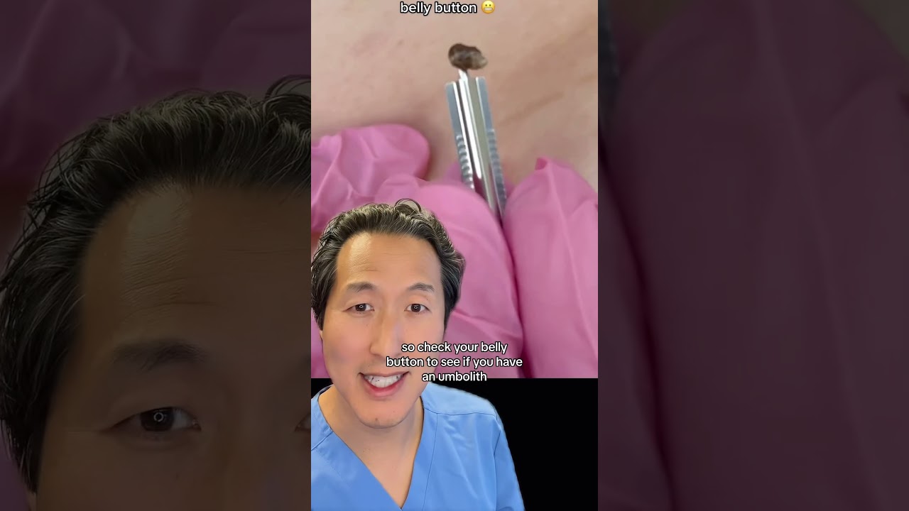 Do You Have a Rock in Your Belly Button? #bellybutton