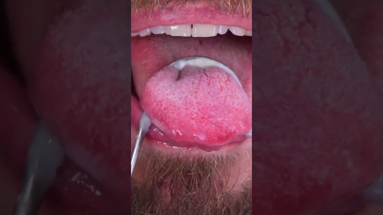 Do you remember to clean your tongue with a scraper? 😱🙈 #shorts