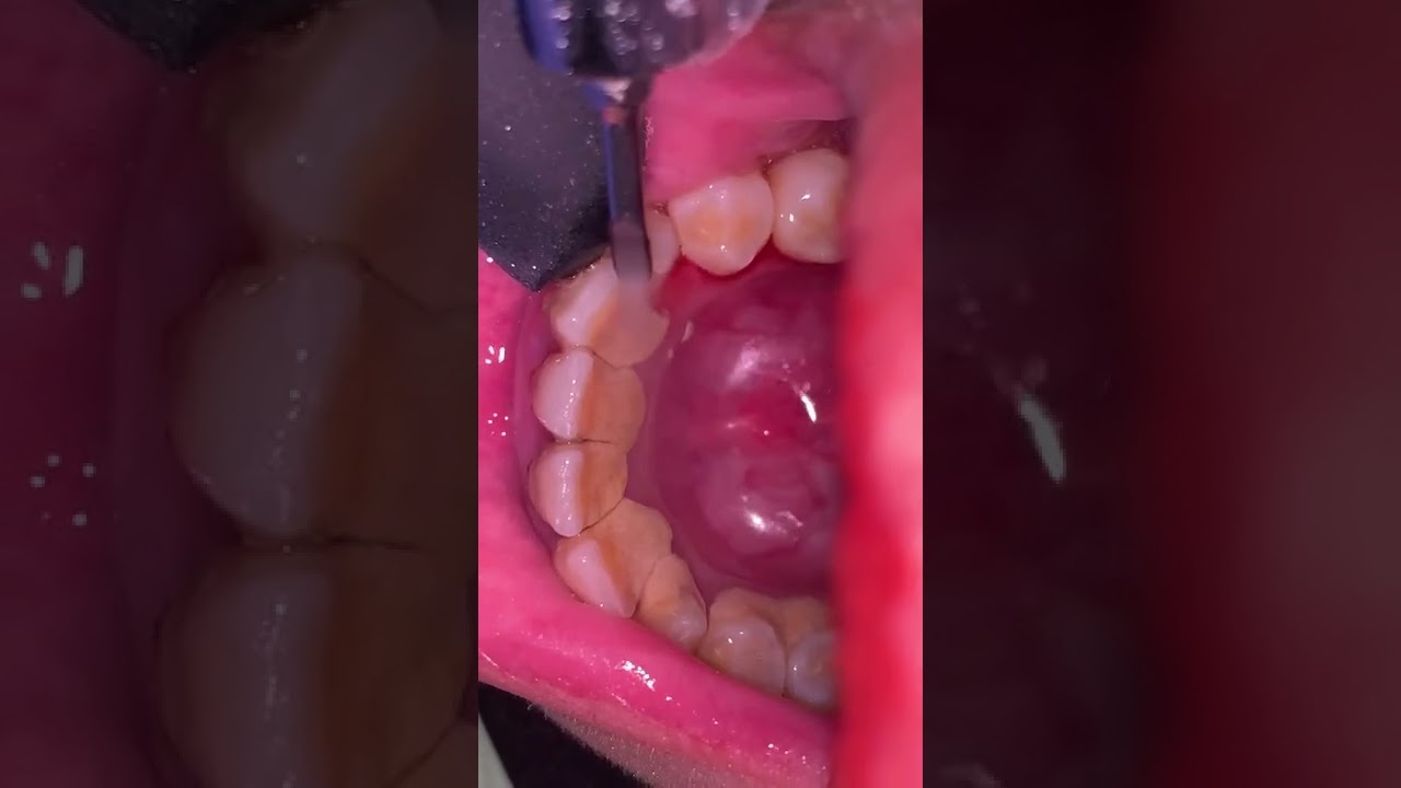 doktergigi_ | Female's Teeth - Dental Surgeon Hub