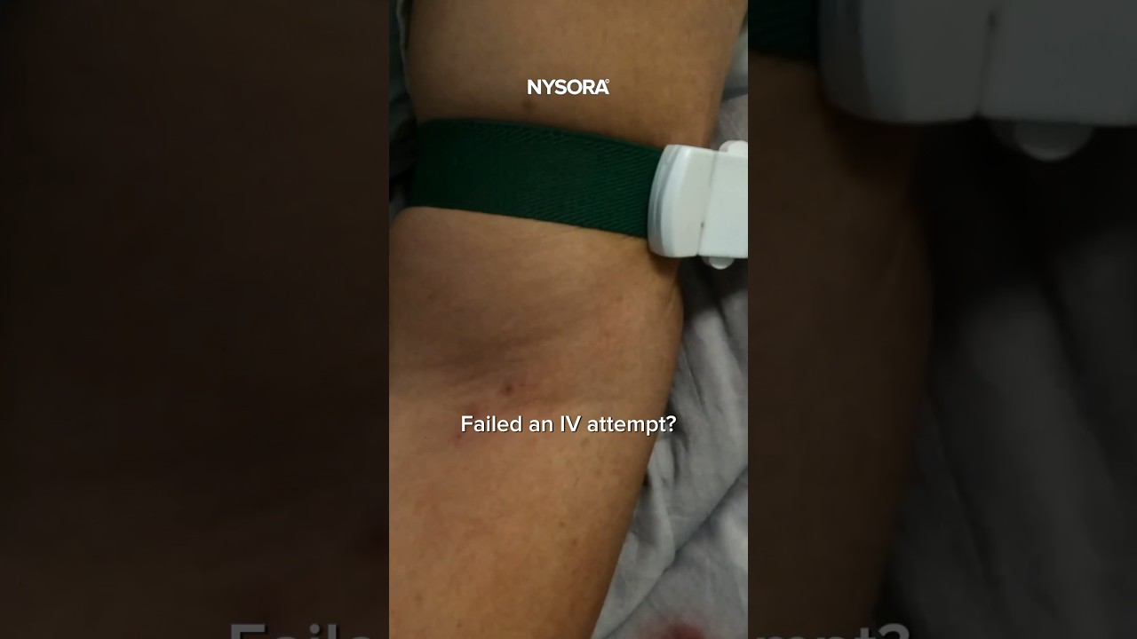 Don't release the tourniquet! #cannulation #iv #intravenous #veins #tourniquet