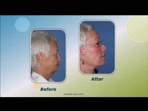Dr. Andrew Wolin's Patient Shares Her Story on YLAZ
