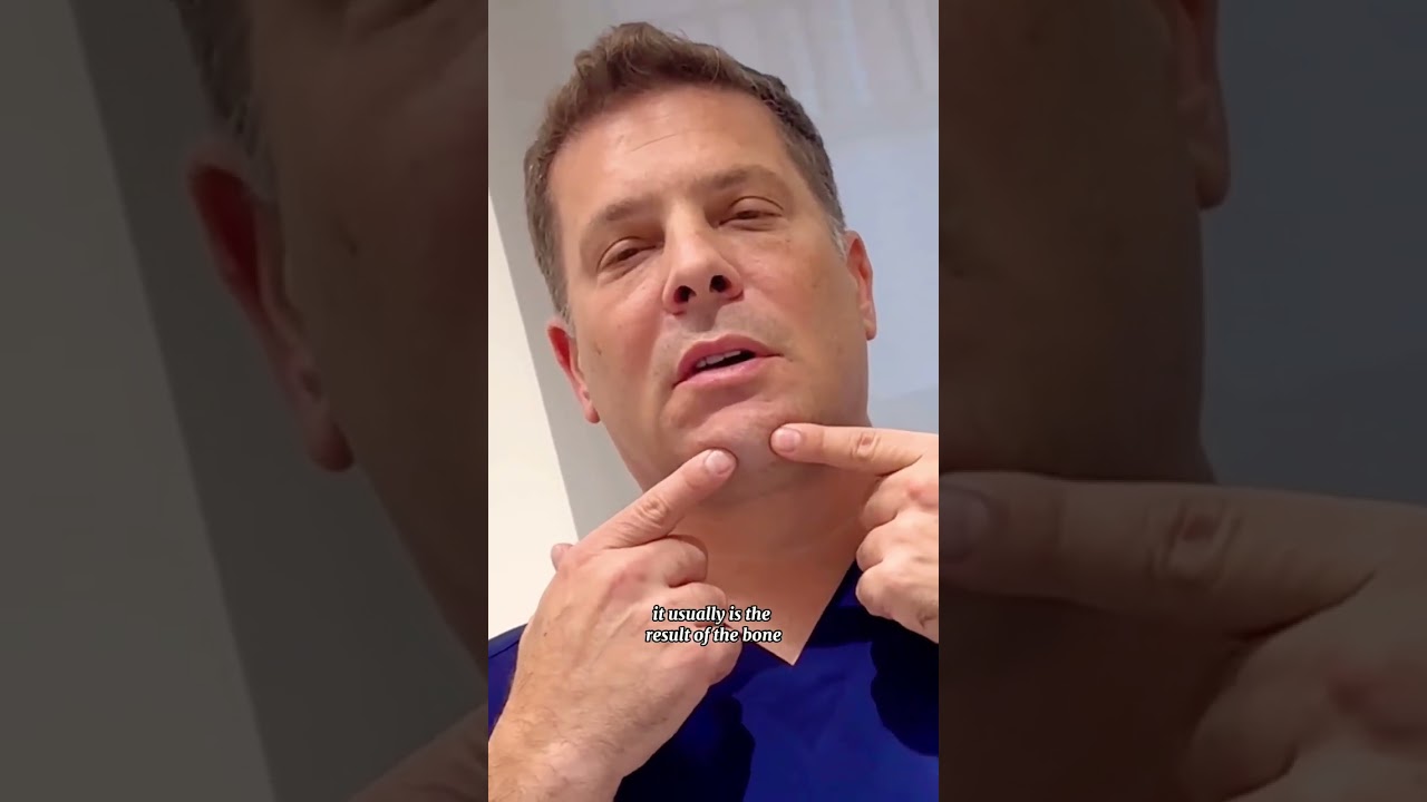 Dr. Rich On Cleft Chins #chin #chinimplants #plasticsurgeon #plasticsurgery #beauty