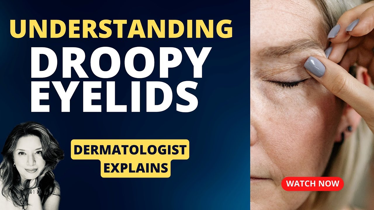 Droopy Eyelids | Dermatochalasis