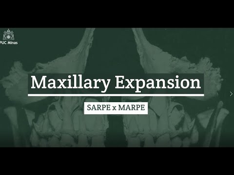 Drop #70 MAXILLARY EXPANSION: SARPE X MARPE