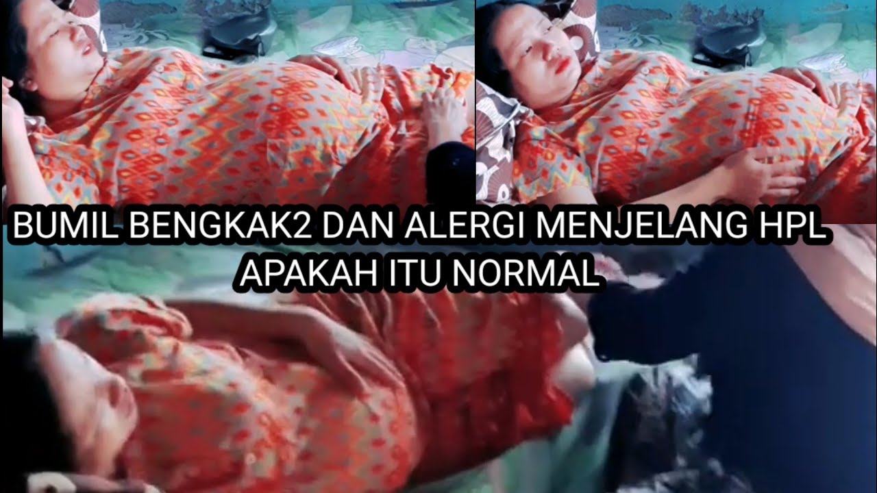 dulu pas menjelang hpl kena bengkak sama alergi.!!siang nya bengkak2 alergi malam nya langsung.hpl
