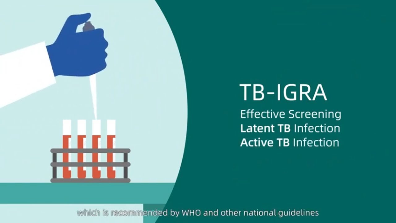 Early Detection, Better Outcomes: Autobio's TB-IGRA Leading the Way