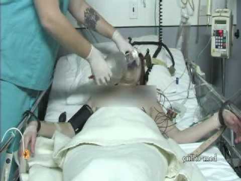 ECT remedy 2