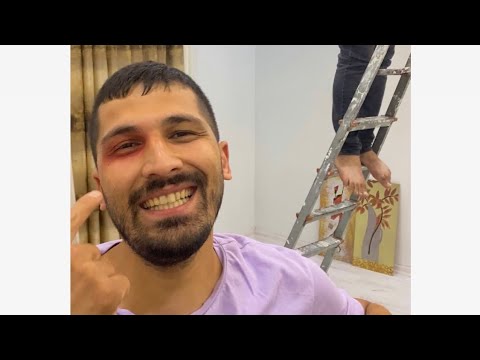 Eşim Gözümü Şişirdi 😂 (MİZAH AMAÇLIDIR)