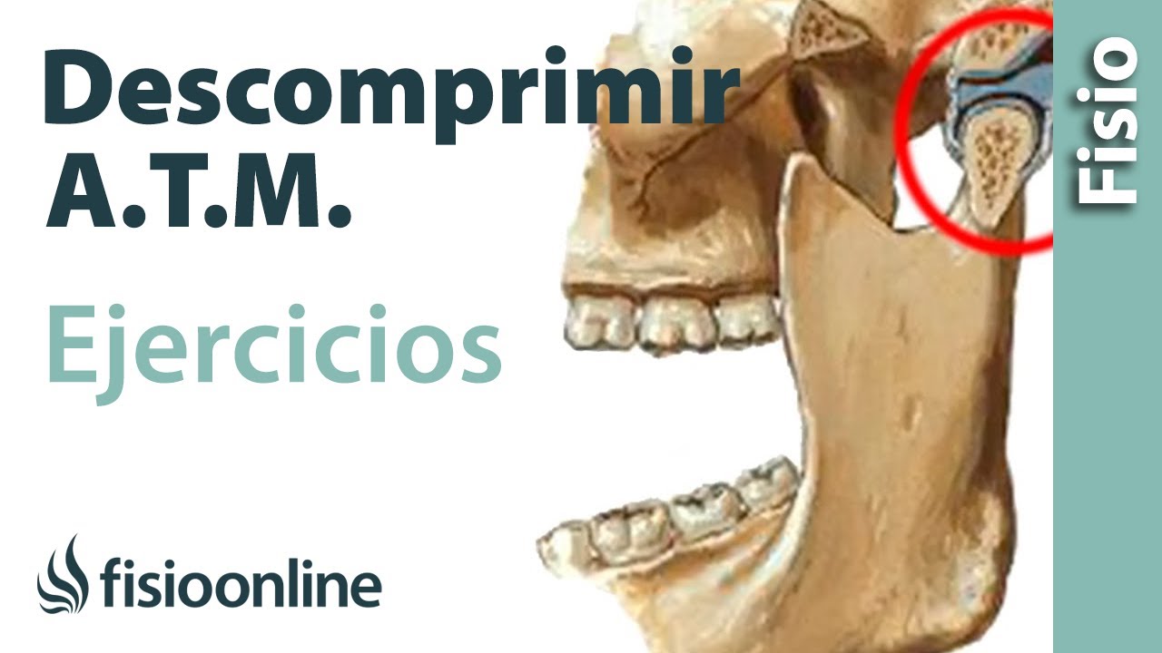 Ejercicio para descomprimir la articulación temporomandibular. A.T.M