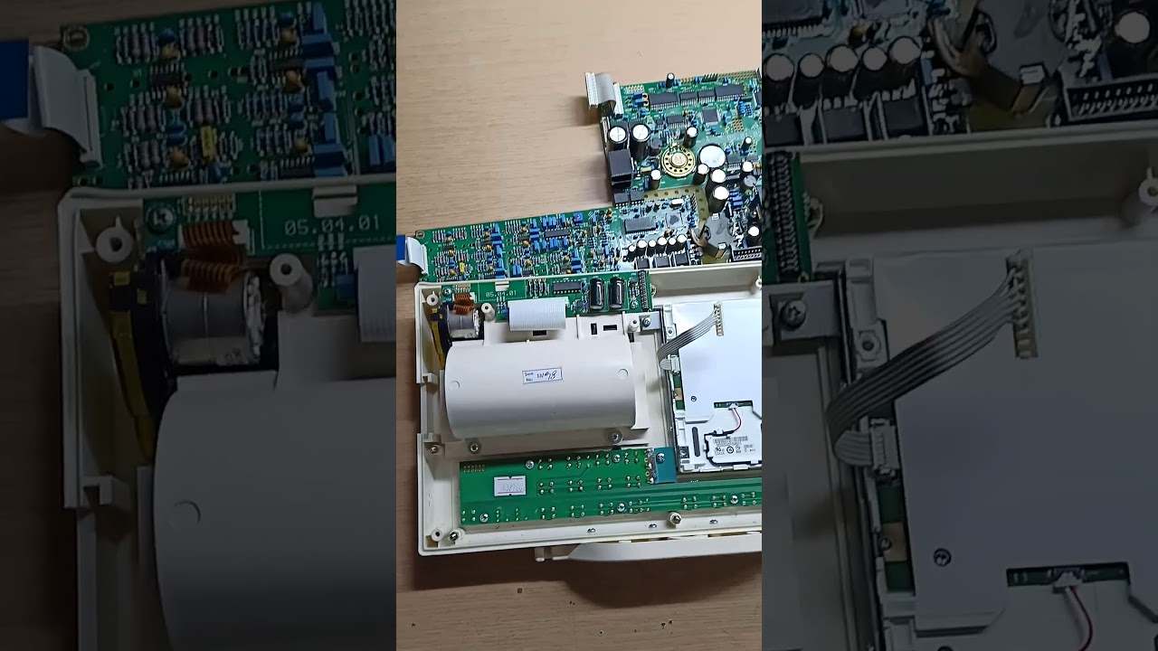 EKG (EKOKARDİYOGRAFİ) CİHAZ ONARIMI