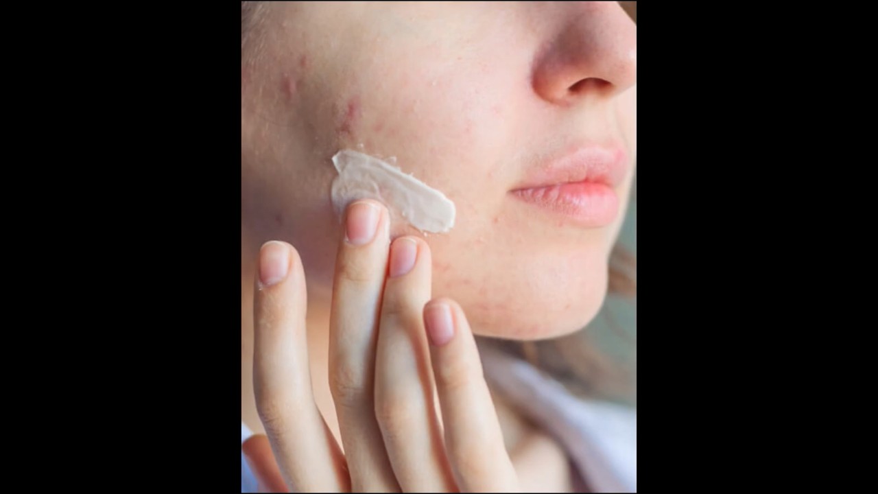 Erytop gel How to use