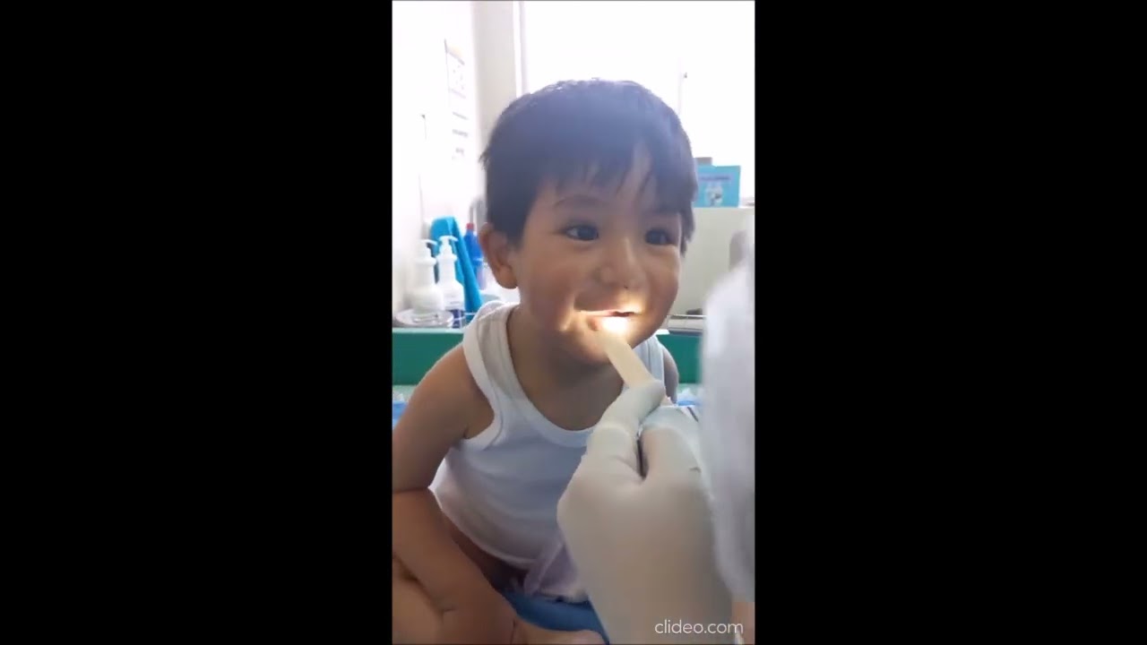EVALUACIÓN FÍSICA DE NIÑO DE UNO A DOS AÑOS