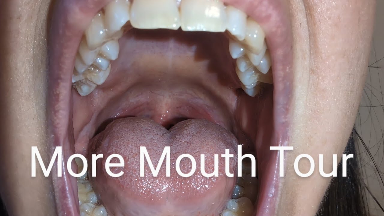 Explore my mouth. Take your time. Teeth Back of Throat Tour
