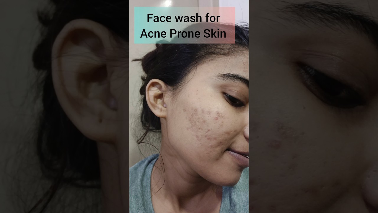 Face Wash for Acne Prone Skin 😍#skincare #acne #shorts