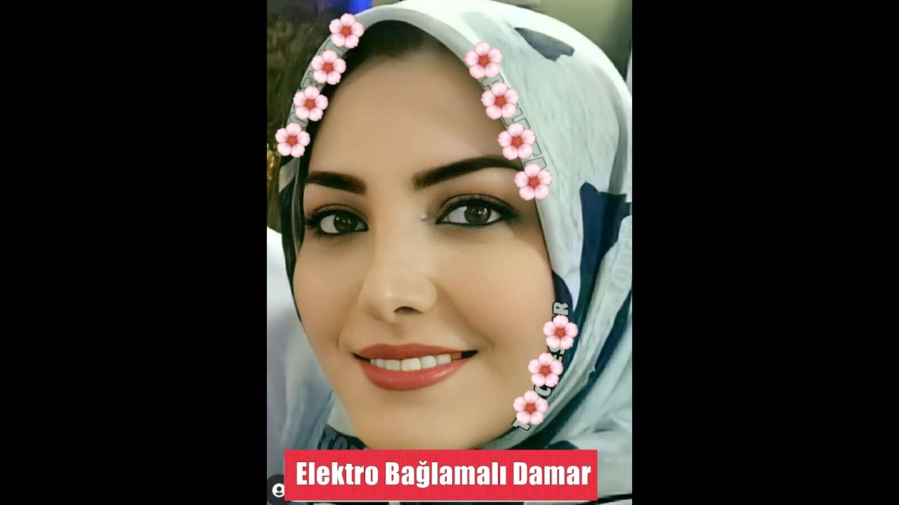 Felek Çakmağını Üstüme Çaktı - Elektro bağlamalı