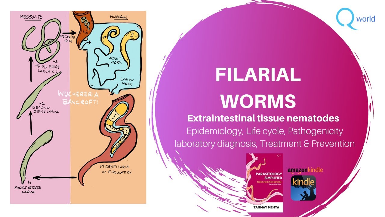 Filarial worms: Wuchereria bancrofti, Brugia malayi, Mansonia, Loa loa Onchocerca volvulus &more