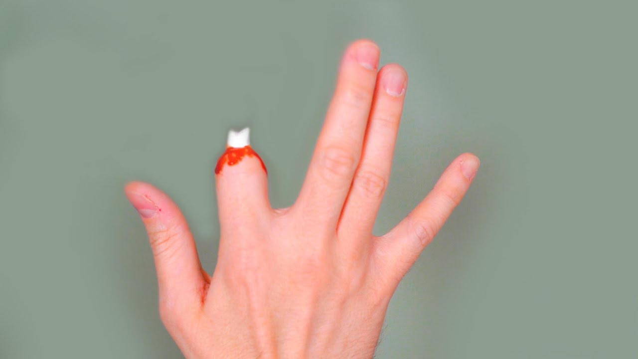 FINGER CUT OFF!