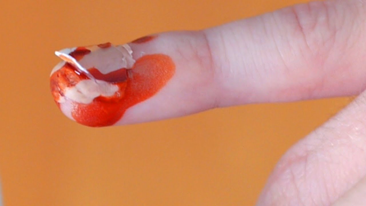 FINGERNAIL COMES OFF!