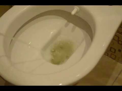 Foamy urine without proteinuria