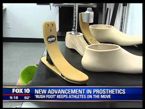 FOX 10 KSAZ New Advancement in Lower Limb Prosthetics - The RUSH Foot