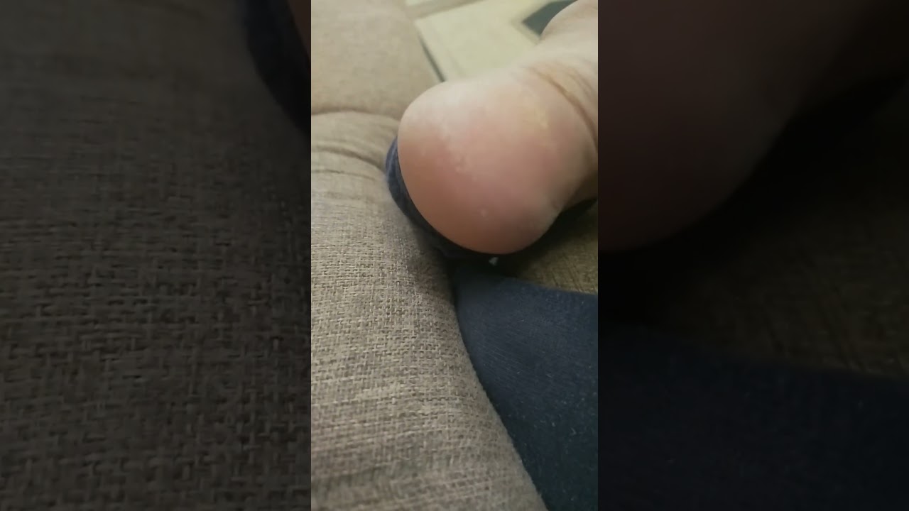 Friend's feet candid close up