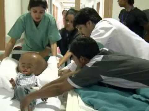 From despair to hope for Indian girl with swollen head