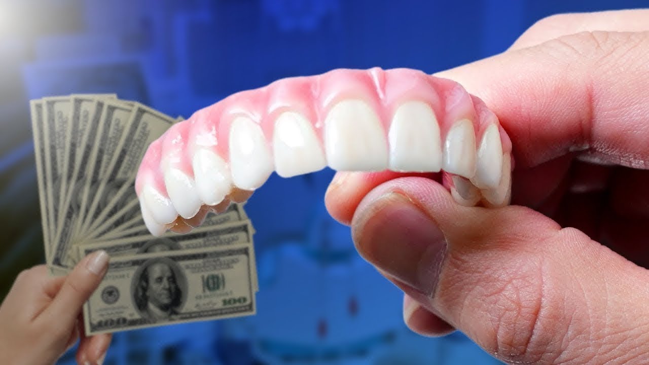 Full Mouth Dental Implant: Cost and Comparison