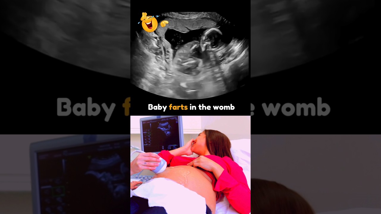 Funny Baby Farts in the Womb😂 Mom Surprised 😯 Just for Fun😂💯 Babies Don't Fart