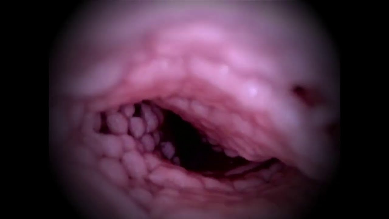 胃腸で消化される小人/Gastrointestinal digested dwarf/giantess vore/丸呑み